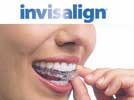 Invisalign Align