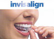 Invisalign