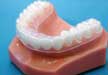 Retainers