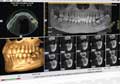 CT Scan