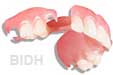 dentures
