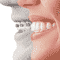 invisalign