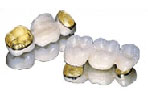 captek bridge