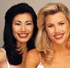 Adult Orthodontics