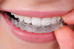 Invisalign®