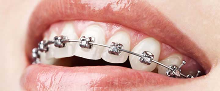 Orthodontic Center @ BIDC