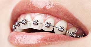 Orthodontic Dentistry